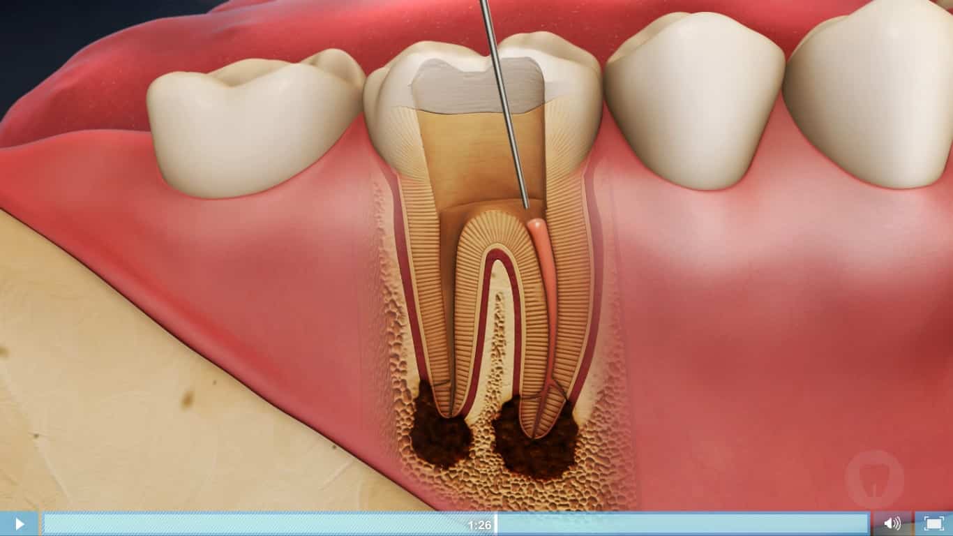 Endodontic Diagnostics and Imaging