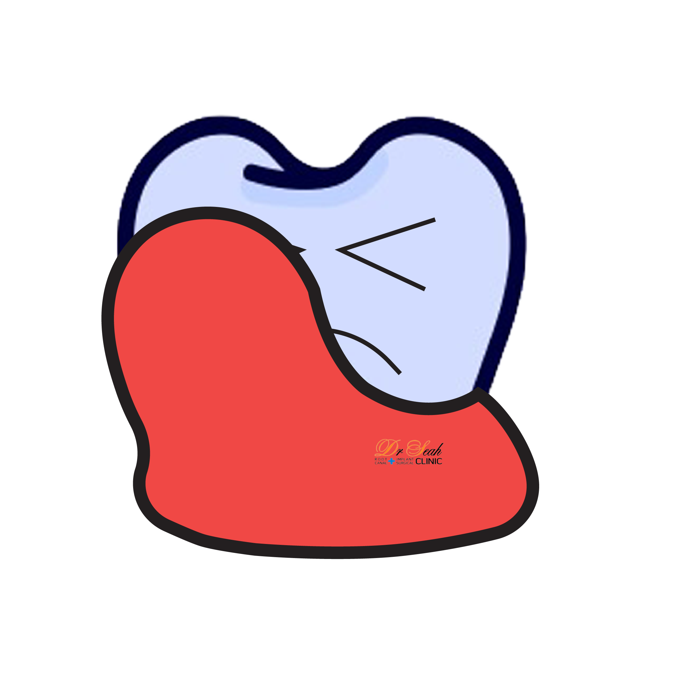 Swollen or Tender Gums