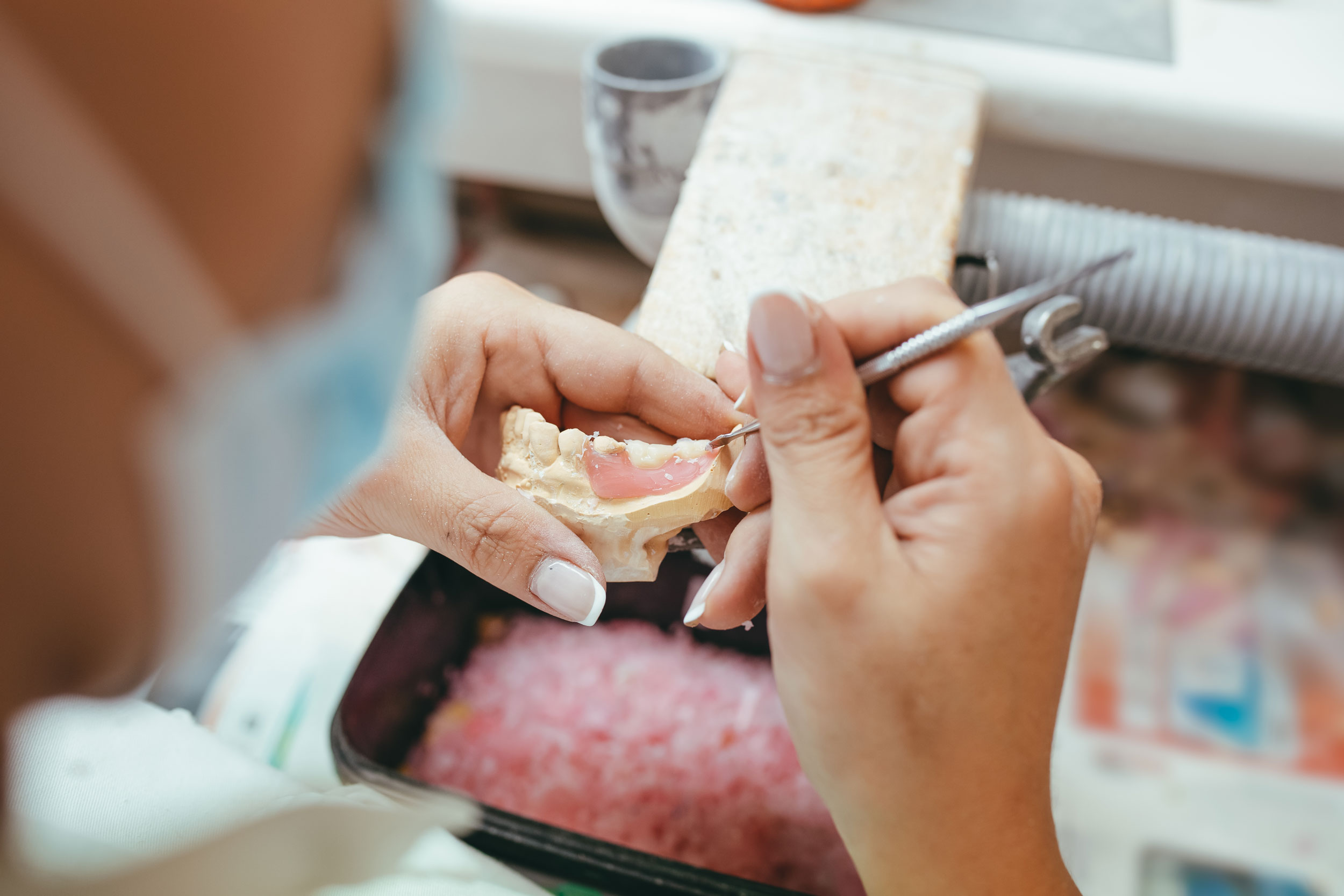 Teeth Crowning Recovery