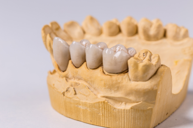 Dental Hygiene Tips Recommended by an Endodontist in Singapore