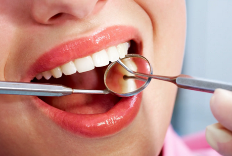 dental bridge singapore