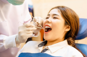 Questions to Ask Your Root Canal Specialist Before Treatment